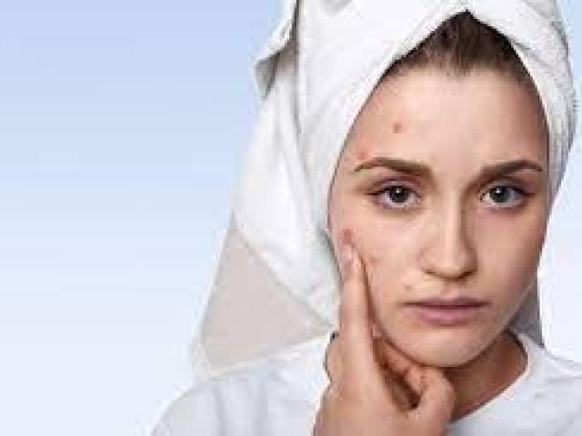 Are Amarose Skin Tag Remover Ingredients Easy On Skin?